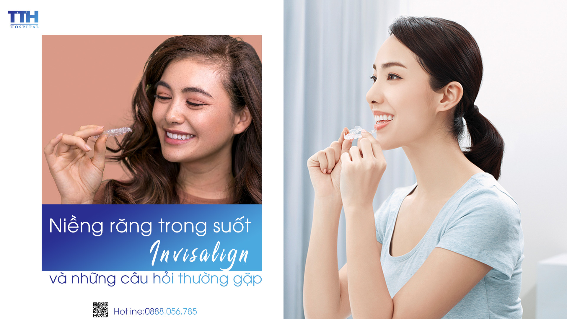 Những câu hỏi thường gặp về Invisalign - Niềng răng trong suốt tại Nghệ An